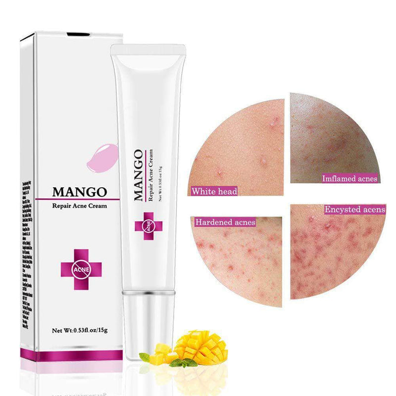 EzCare Mango Repair Acne Cream | Anti-Acne Treatment